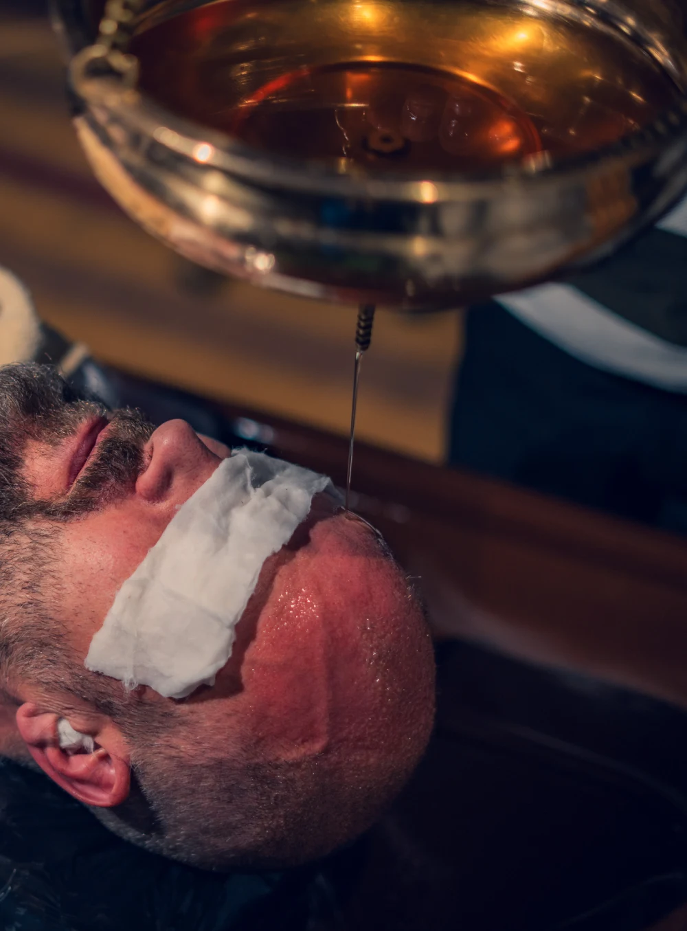 Warm herbal oil poured in a Shirodhara Ayurvedic therapy