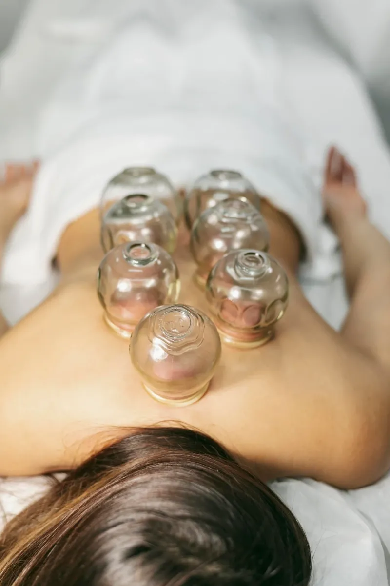 Glass cups placed along a woman&rsquo;s back during cupping therapy