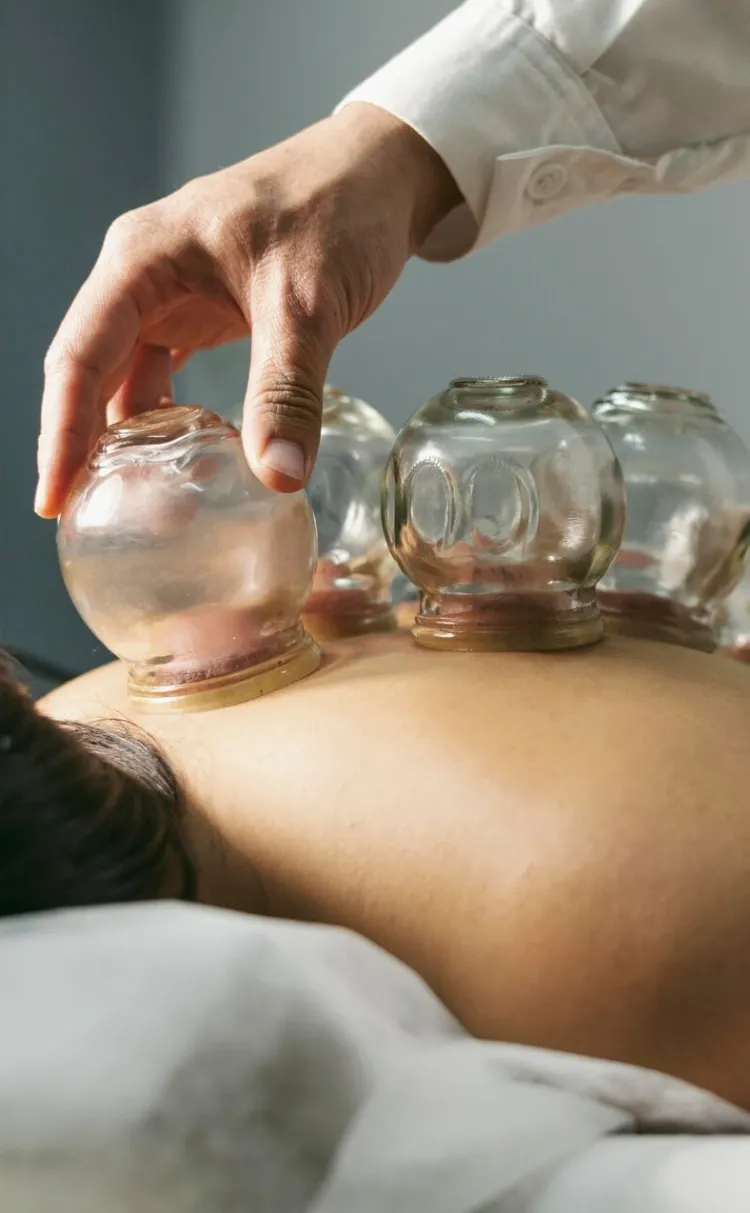 A therapist setting a glass cup on a client&rsquo;s back