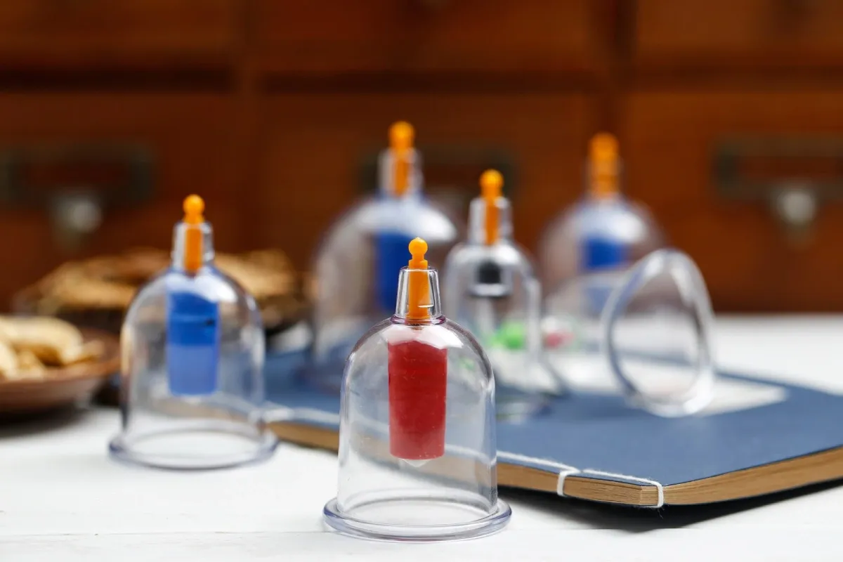 A set of glass vacuum cupping cups on a therapy table