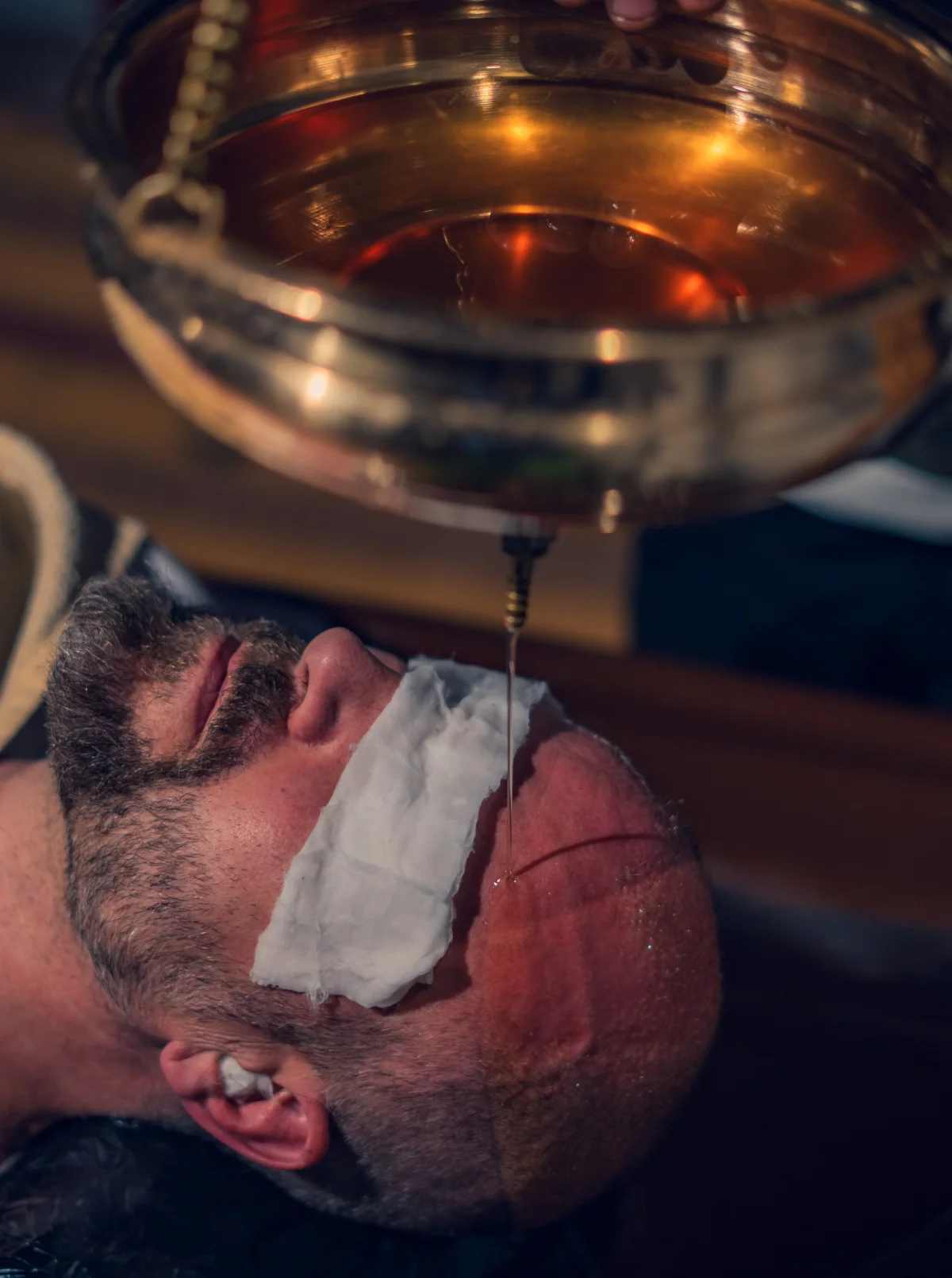 Warm oil flowing onto the forehead during Shirodhara